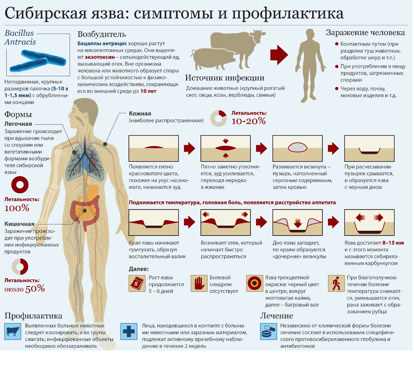 Сибирская язва.